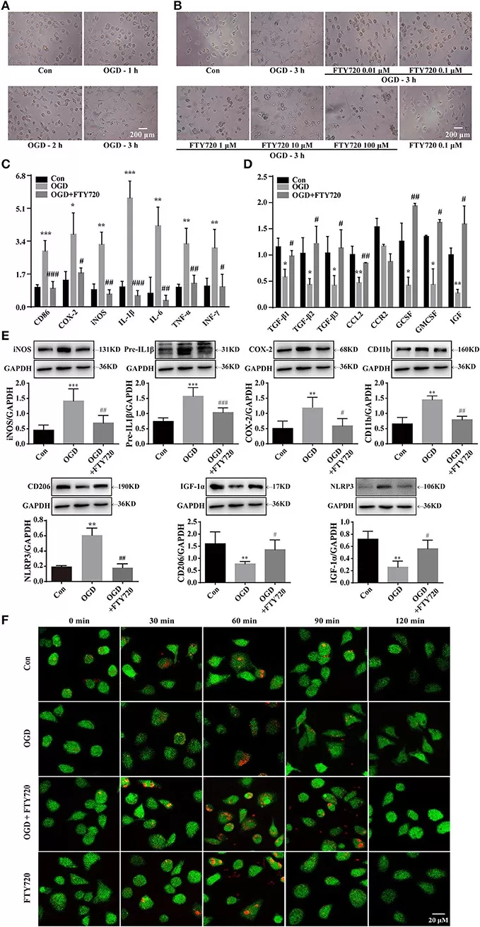 Immunofluorescence and quantification showing that in an MCAO rat model, fingolimod (FTY720) treatment lowers IL-1β/TNF-α and iNOS+ M1 microglia, while increasing TREM2+/Iba1+ M2 microglia in peri-infarct cortex; effects depend on nuclear SphK2–S1P signaling and HDAC1 inhibition.